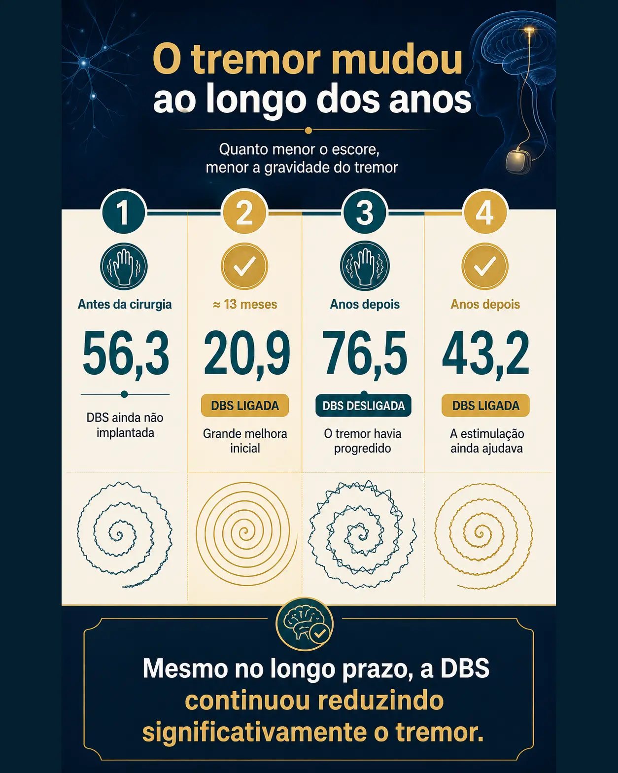 Comparação dos escores de tremor antes da cirurgia, no primeiro ano e no acompanhamento tardio