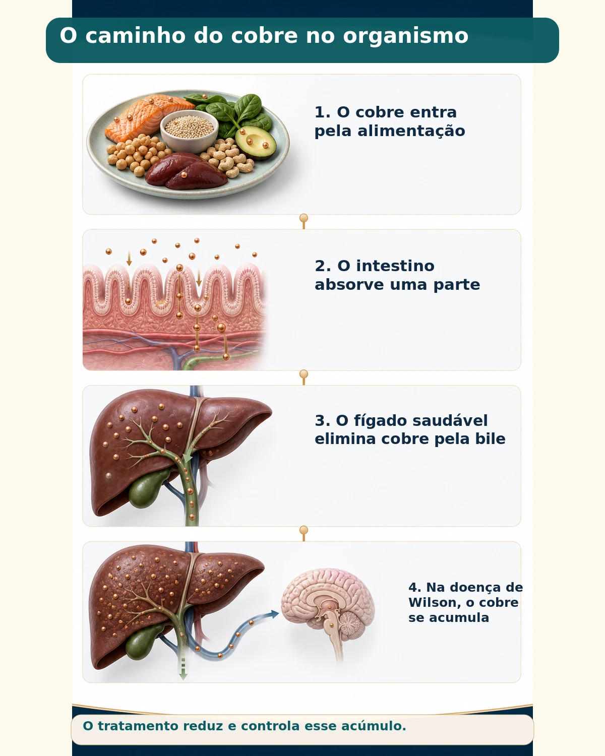 Fluxo do cobre desde a alimentação até o fígado, comparando a eliminação normal com o acúmulo na doença de Wilson