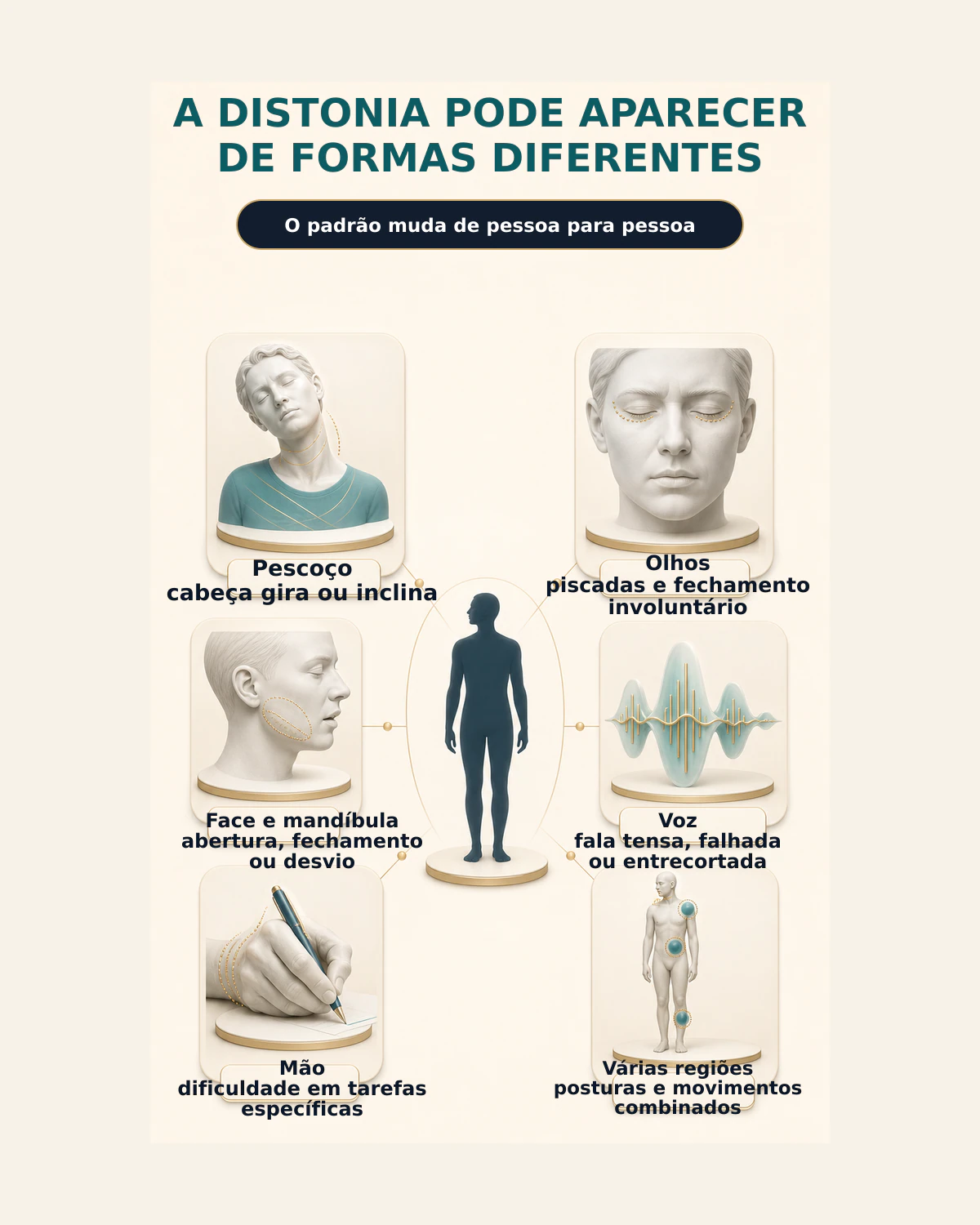 Infográfico sobre manifestações da distonia no pescoço, olhos, mandíbula, voz, mão e várias regiões do corpo