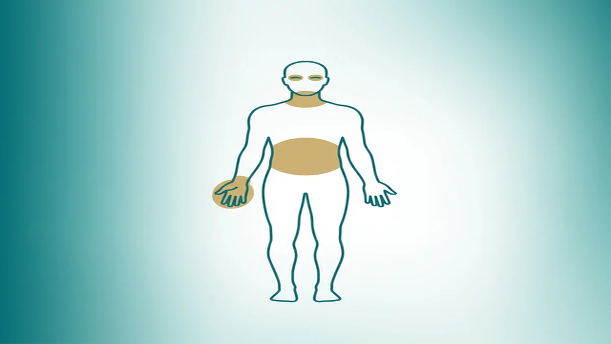 Ilustração editorial de diferentes regiões do corpo afetadas por distonia, em estilo flat design médico com paleta azul-petróleo e dourado