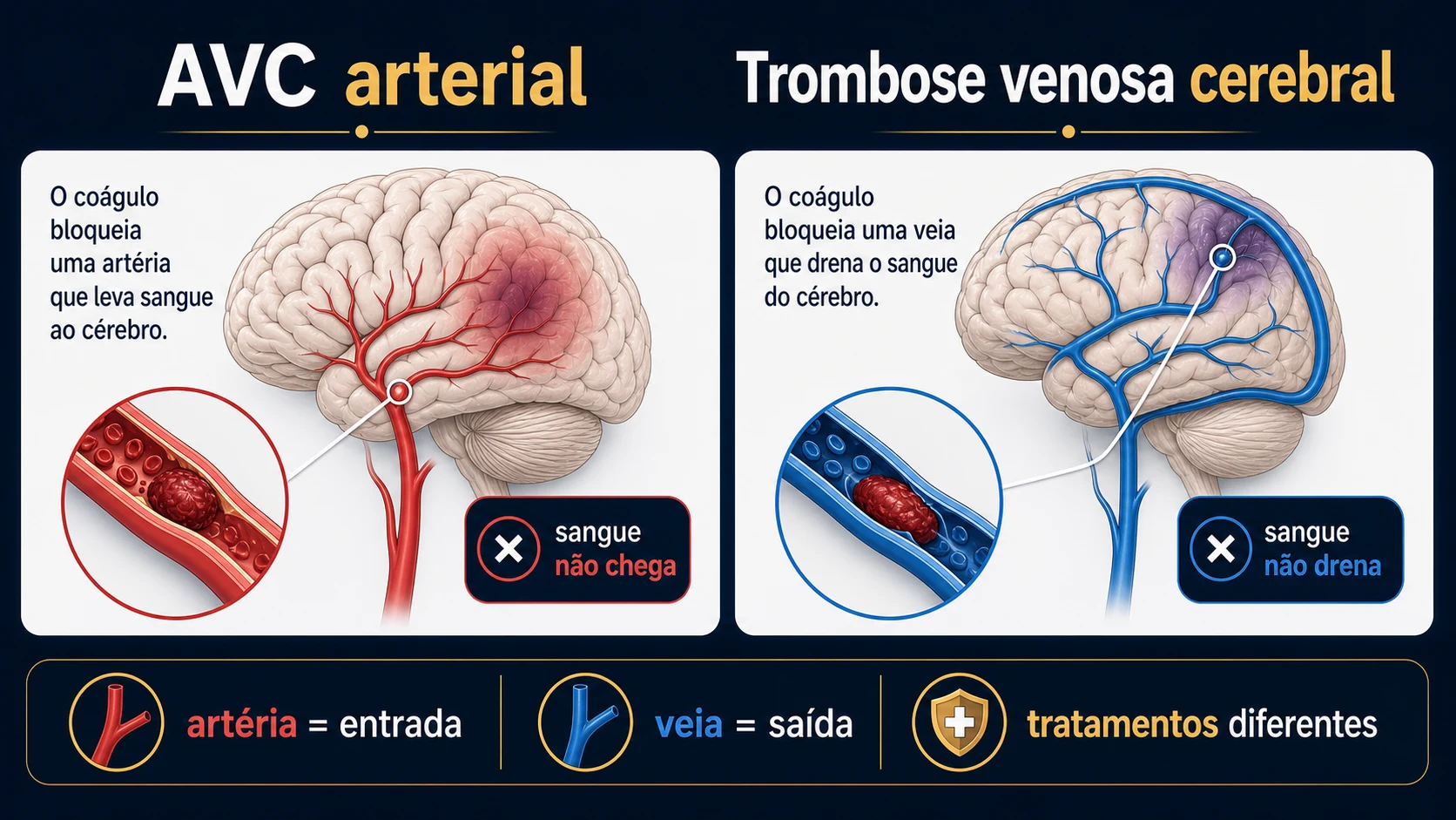 Infográfico comparando AVC arterial e trombose venosa cerebral