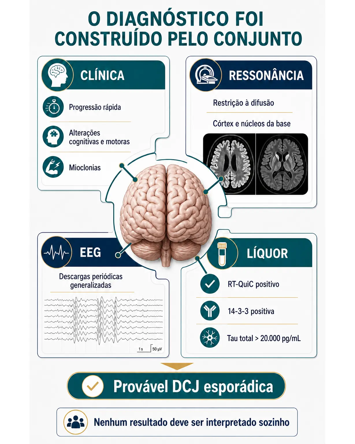 Infográfico mostrando que o diagnóstico provável de doença de Creutzfeldt-Jakob foi sustentado pela combinação de clínica, ressonância, EEG e líquor.