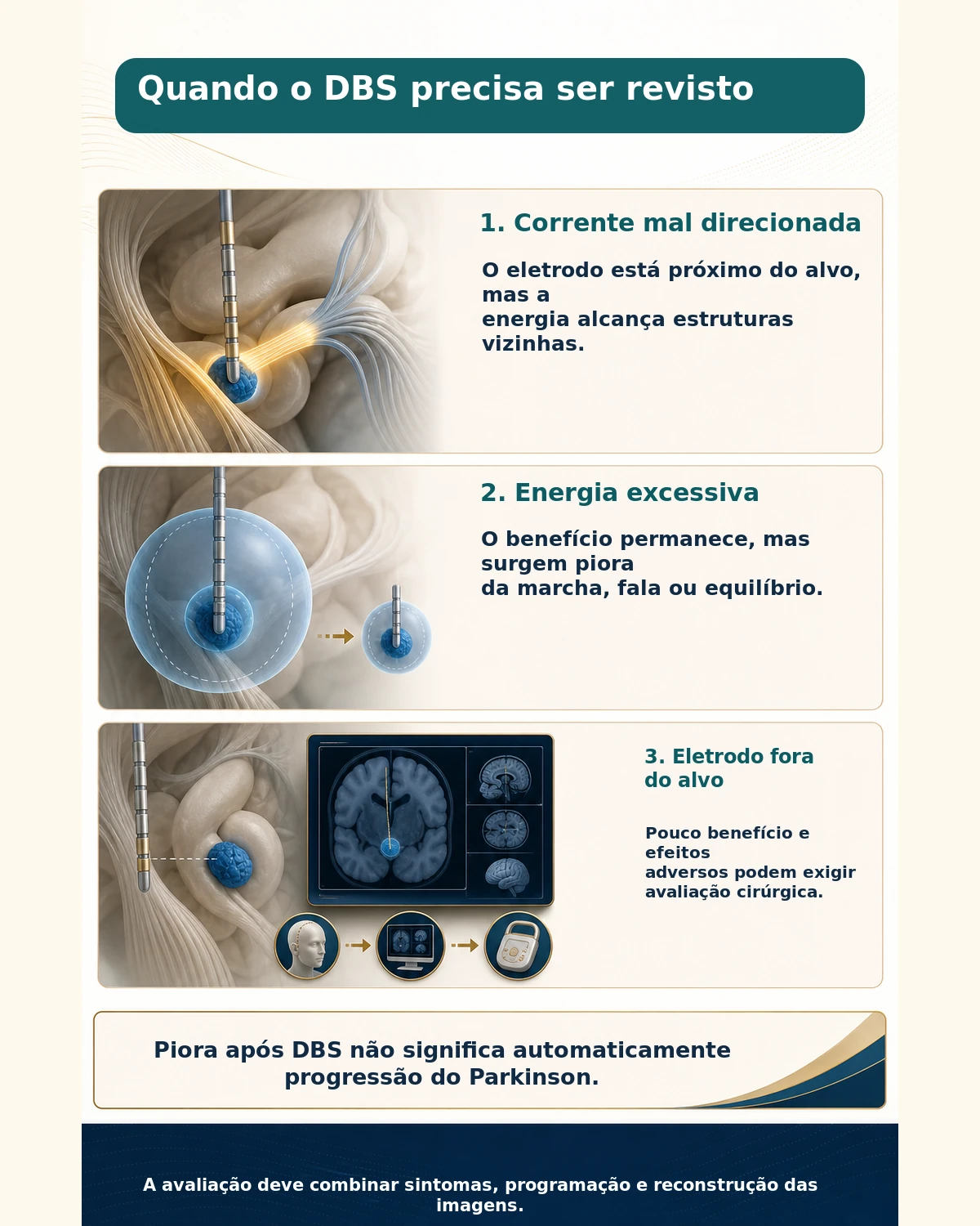 Infográfico com três causas de resultados insatisfatórios após DBS: direcionamento subótimo, energia excessiva e eletrodo fora do alvo