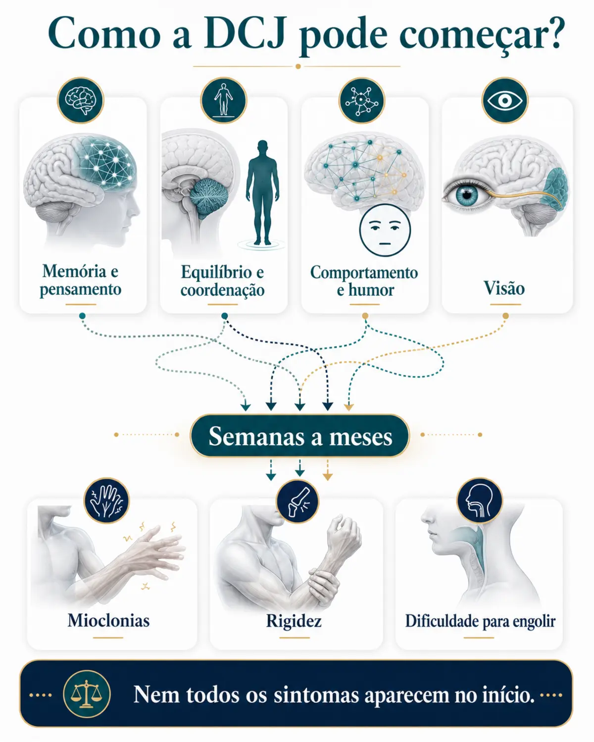 Infográfico mostrando diferentes formas de início e progressão dos sintomas da doença de Creutzfeldt-Jakob